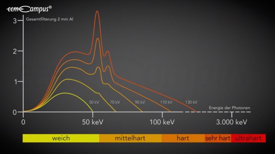ultraharte Strahlung
