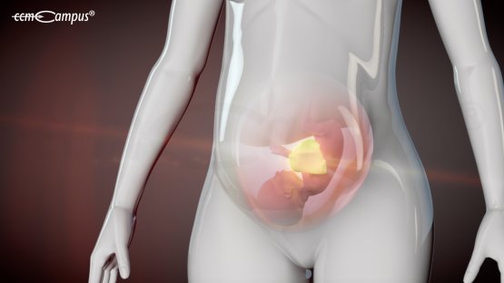 Schwangerenüberwachung