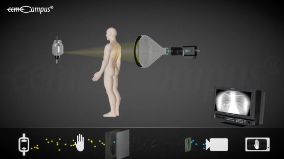 Röntgenbildverstärker